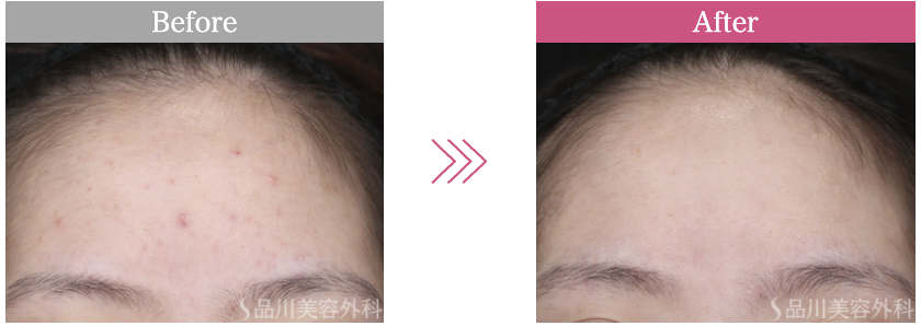 品川美容外科ポテンツァ