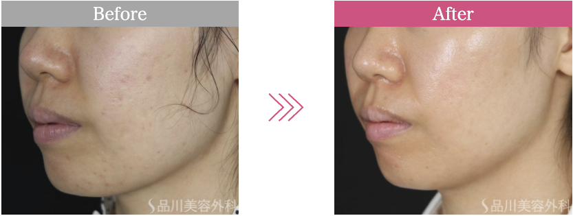 品川美容外科　症例