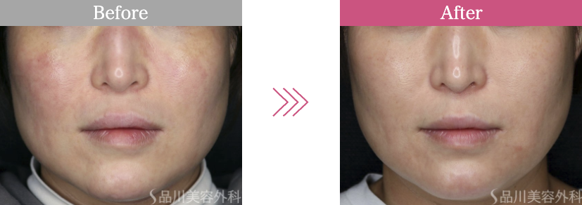 品川美容外科ポテンツァ