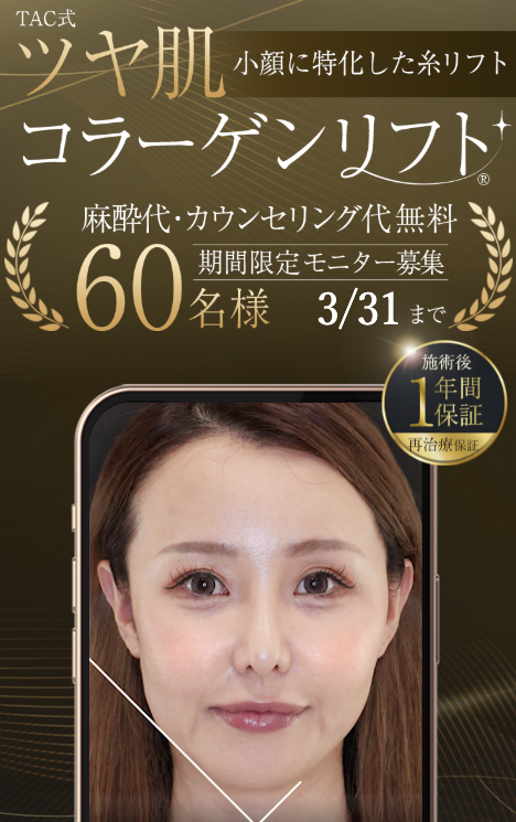 TAクリニック 糸リフト