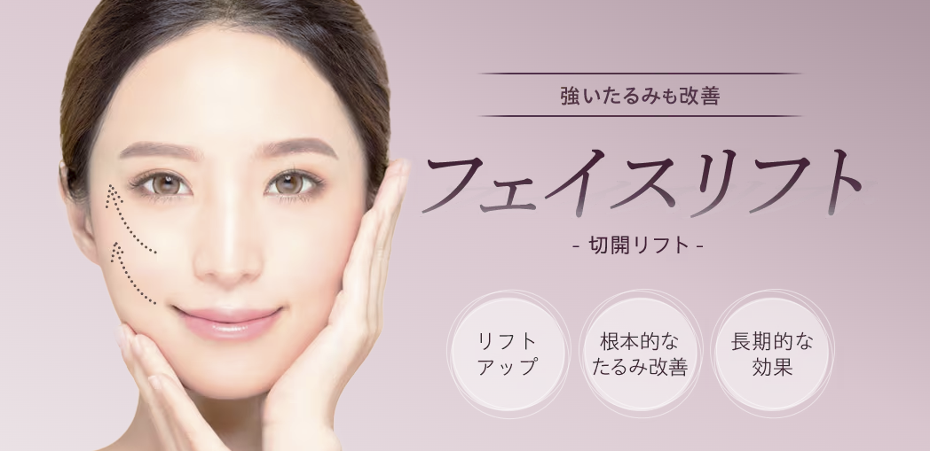 湘南美容クリニックフェイスリフト