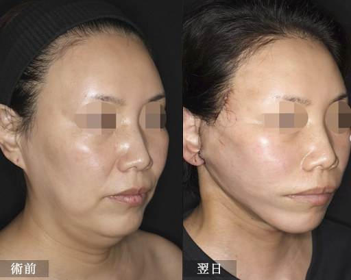 リッツ　佐藤大輔　症例