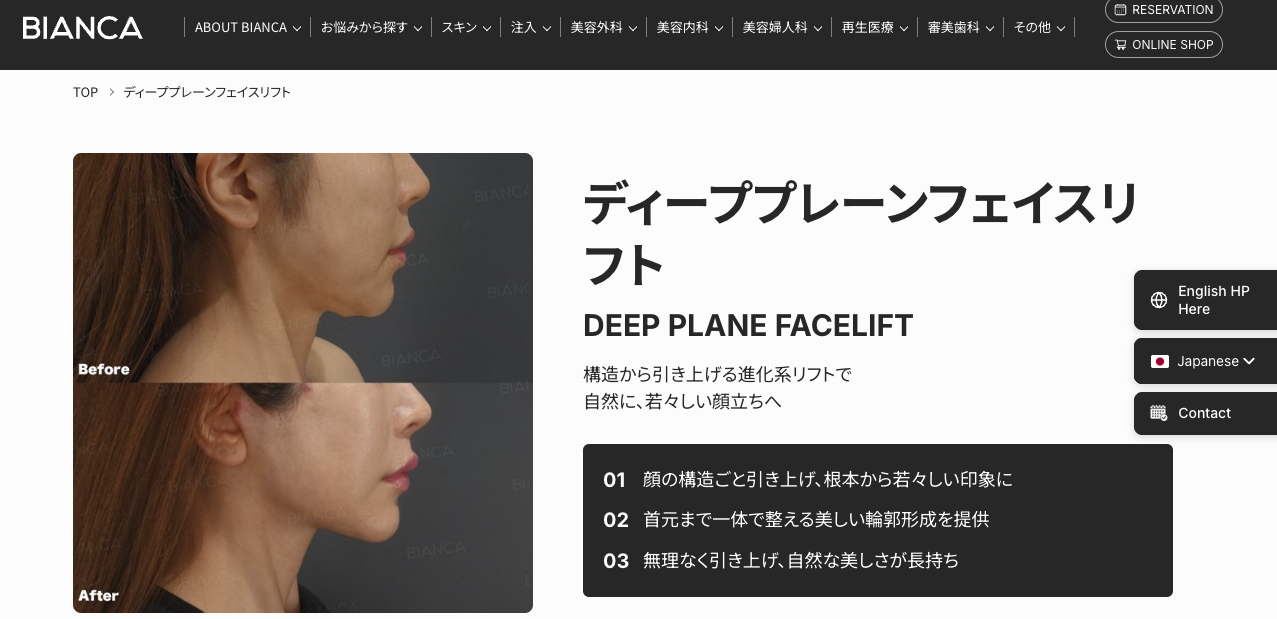 ビアンカ　フェイスリフト