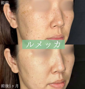 ルラ美容クリニック症例写真