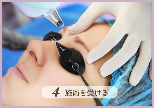 Step4.施術を受ける