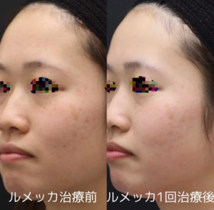 sherieクリニック症例写真
