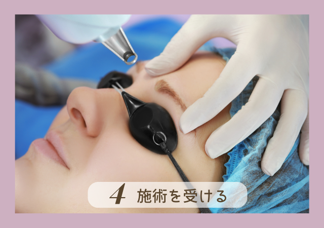 4.施術を受ける