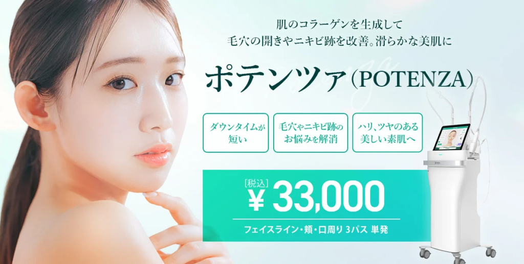 TCBポテンツァ