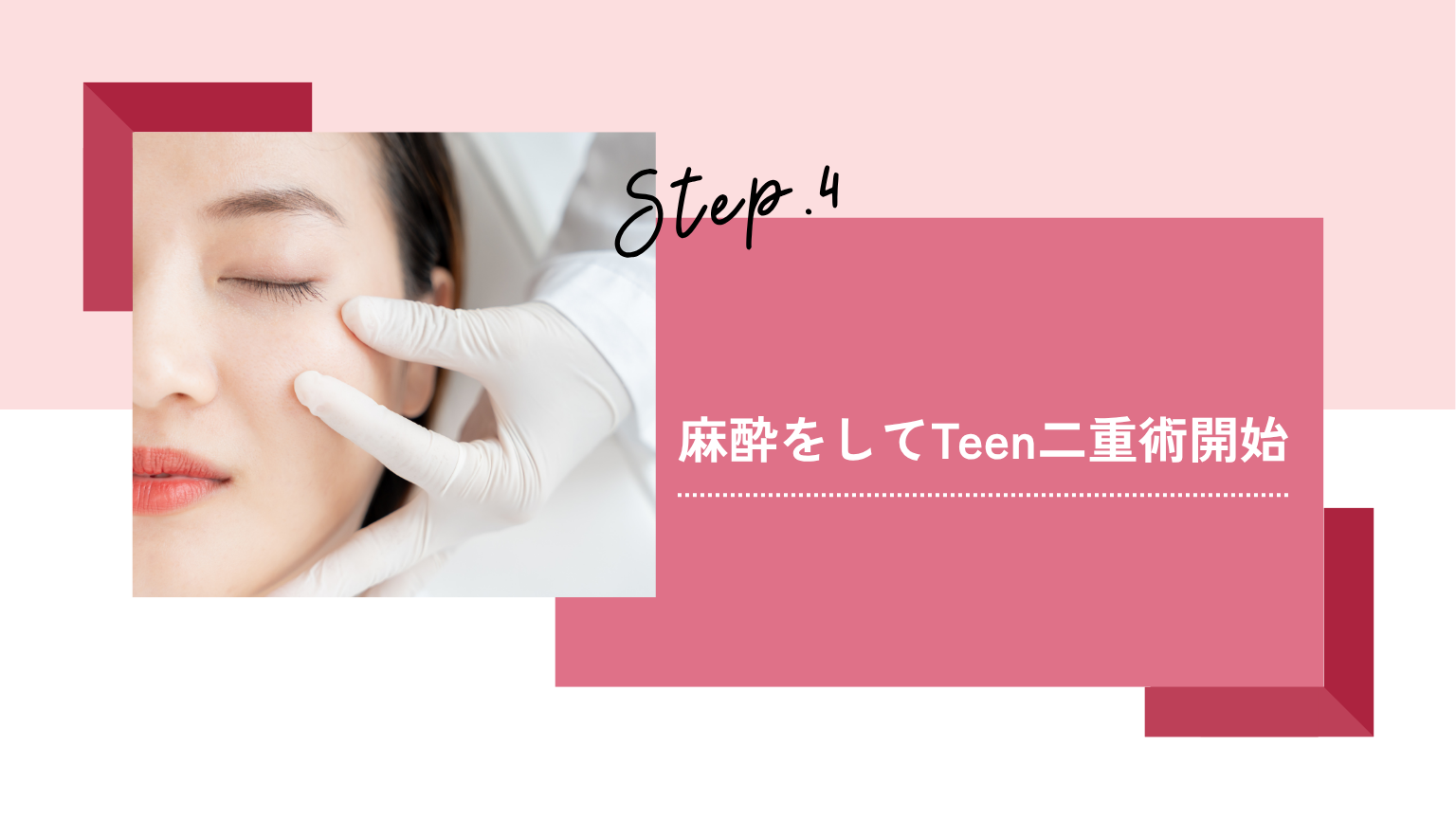 麻酔をしてTeen二重施術開始