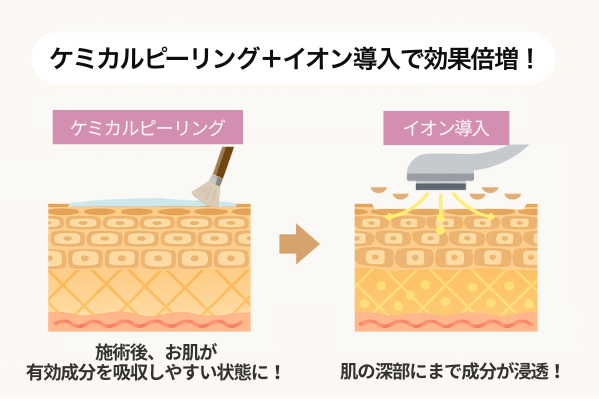 ケミカルピーリングとイオン導入の併用