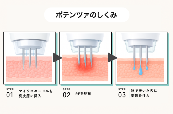 ポテンツァのしくみ