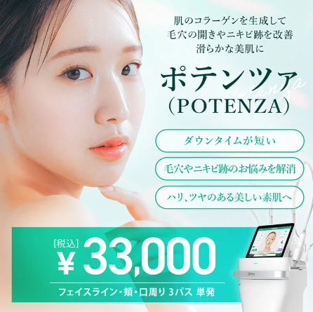 TCBのポテンツァ