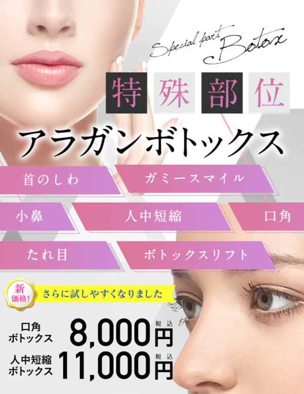 湘南美容クリニックのマイクロボトックス