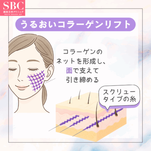 うるおいコラーゲンリフトとは