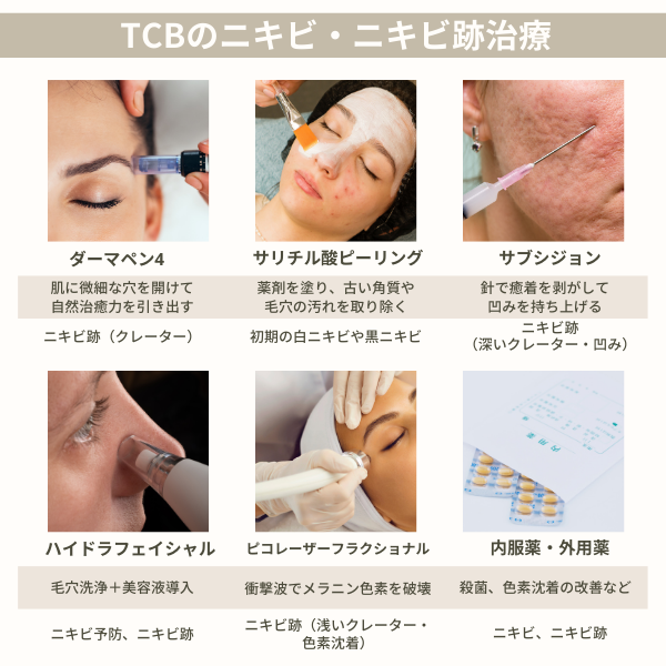 TCBのニキビ治療・ニキビ跡治療の種類と特徴