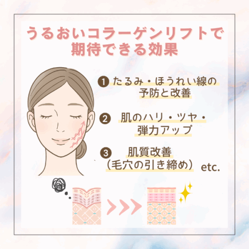 うるおいコラーゲンリフトの効果