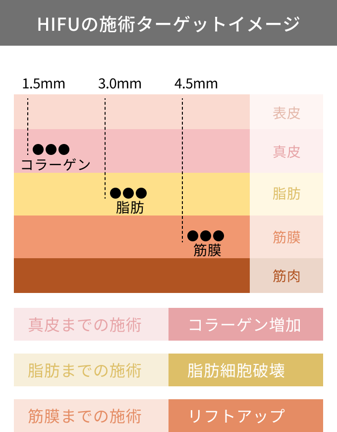 ハイフの施術ターゲットイメージ