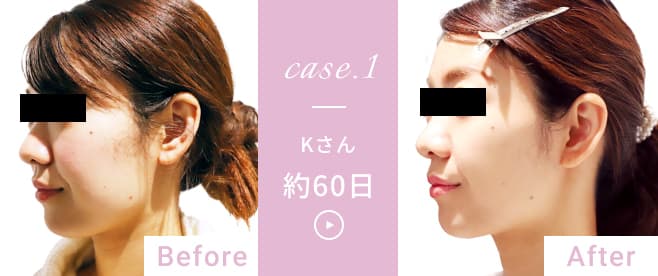 case1