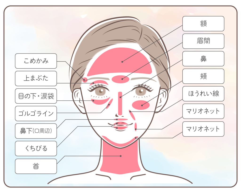 体験レポート マスク生活 お疲れ顔 を撃退 凹んだ鼻 目の小じわにヒアルロン酸注入してみた ファイヤークリニック 医療ダイエット専門