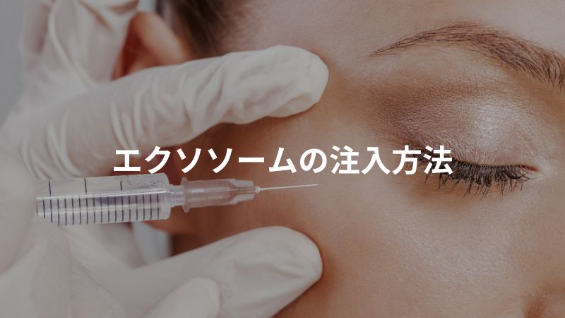 エクソソーム3つの注入方法の違い